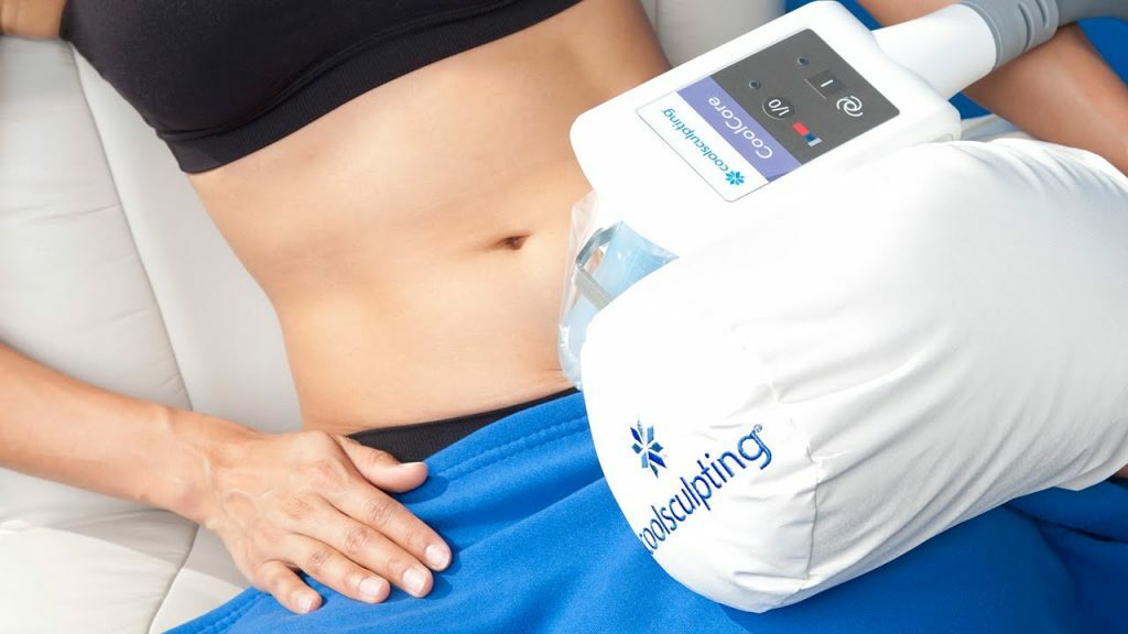 coolsculpting non-surgical fat reduction