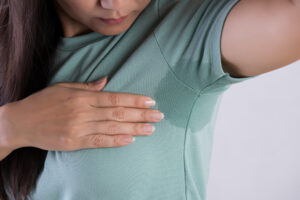 close up of woman with hyperhidrosis, sweating